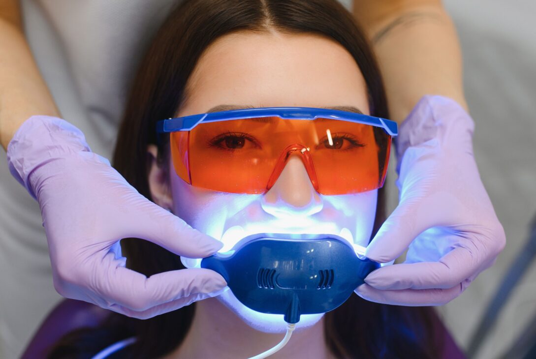 Opalescence Teeth Whitening