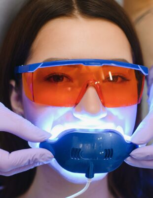 Opalescence Teeth Whitening