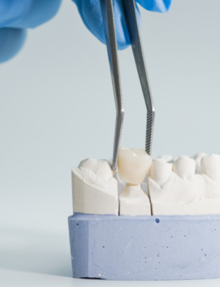 Restorative Dental Treatment