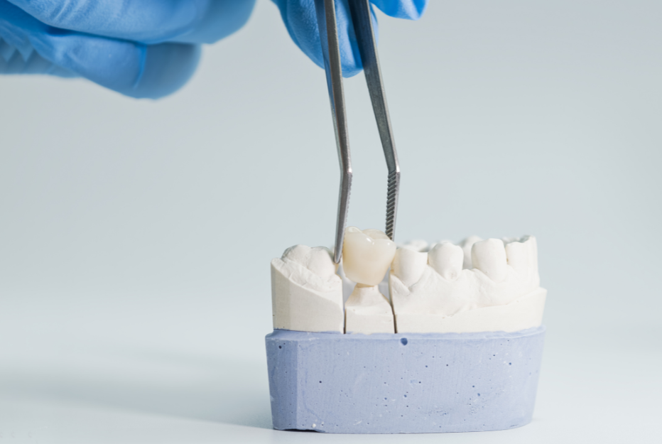 Restorative Dental Treatment